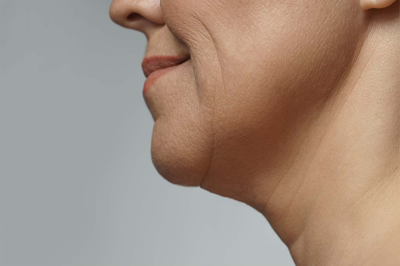 Liposukcja twarzy